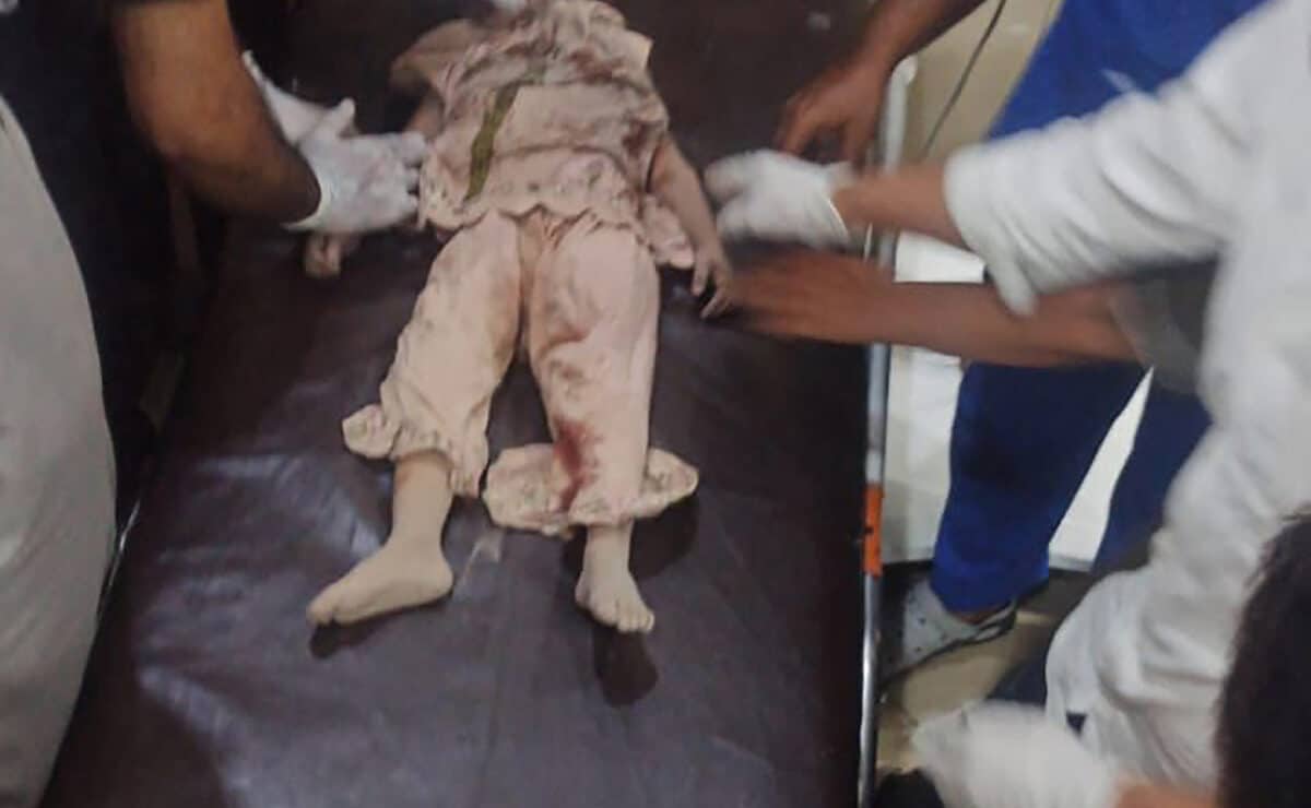 This handout photograph released by the Pakistan's Inter Services Public Relations on May 7, 2025 shows paramedics giving treatment to an injured person at a hospital in Bahawalpur, Punjab province, following strikes in Pakistan. India fired missiles at Pakistani territory early on May 7 in a major escalation of tensions between the nuclear-armed rivals, with Islamabad vowing retaliation. — Agence France-Presse